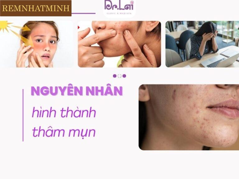 Nguyên nhân khiến thâm mụn kéo dài nhiều năm không mờ