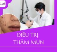 Hỗ trợ từ bên trong khi cần thiết